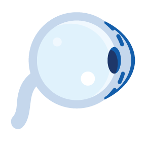 Glaucoma Icon